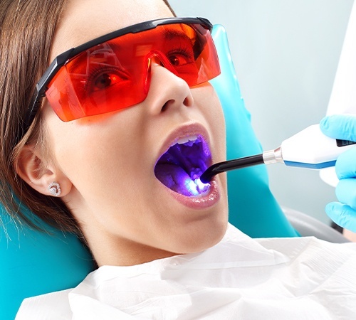 Dental Sealants Treatment In Houston TX