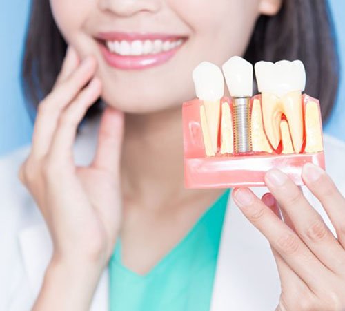 Implant dentist in Houston holding model of dental implant