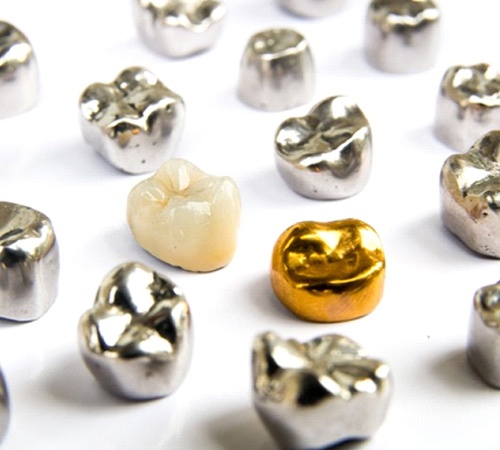 multiple dental crowns made of various materials