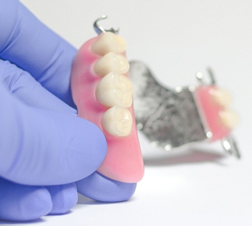 Dentist holding model of partial denture