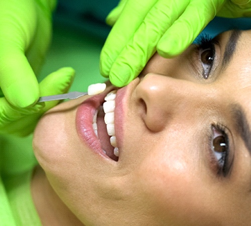woman visiting her Houston cosmetic dentist for veneers