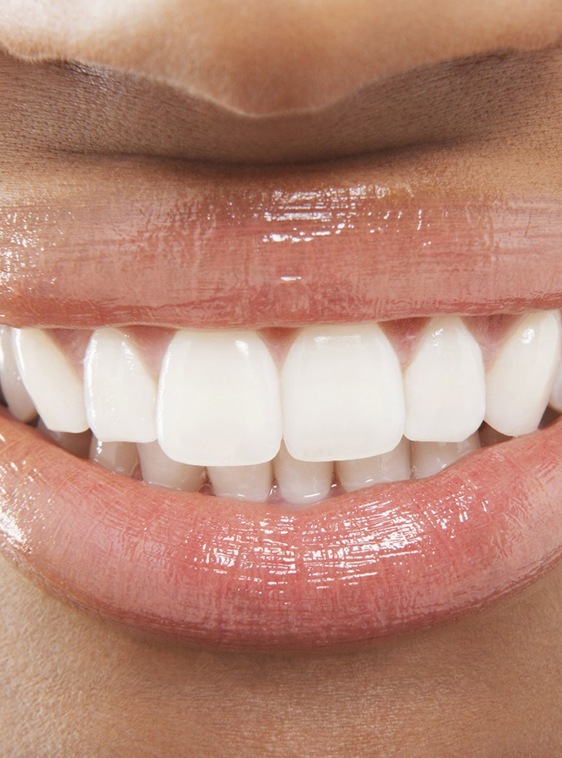 Closeup of woman's white teeth and beautiful smile