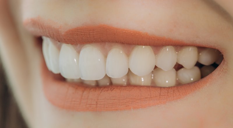 Porcelain veneers in Houston
